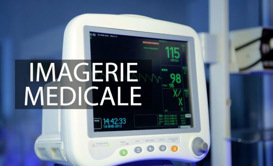 TB_Imagerie_Medicale_V2